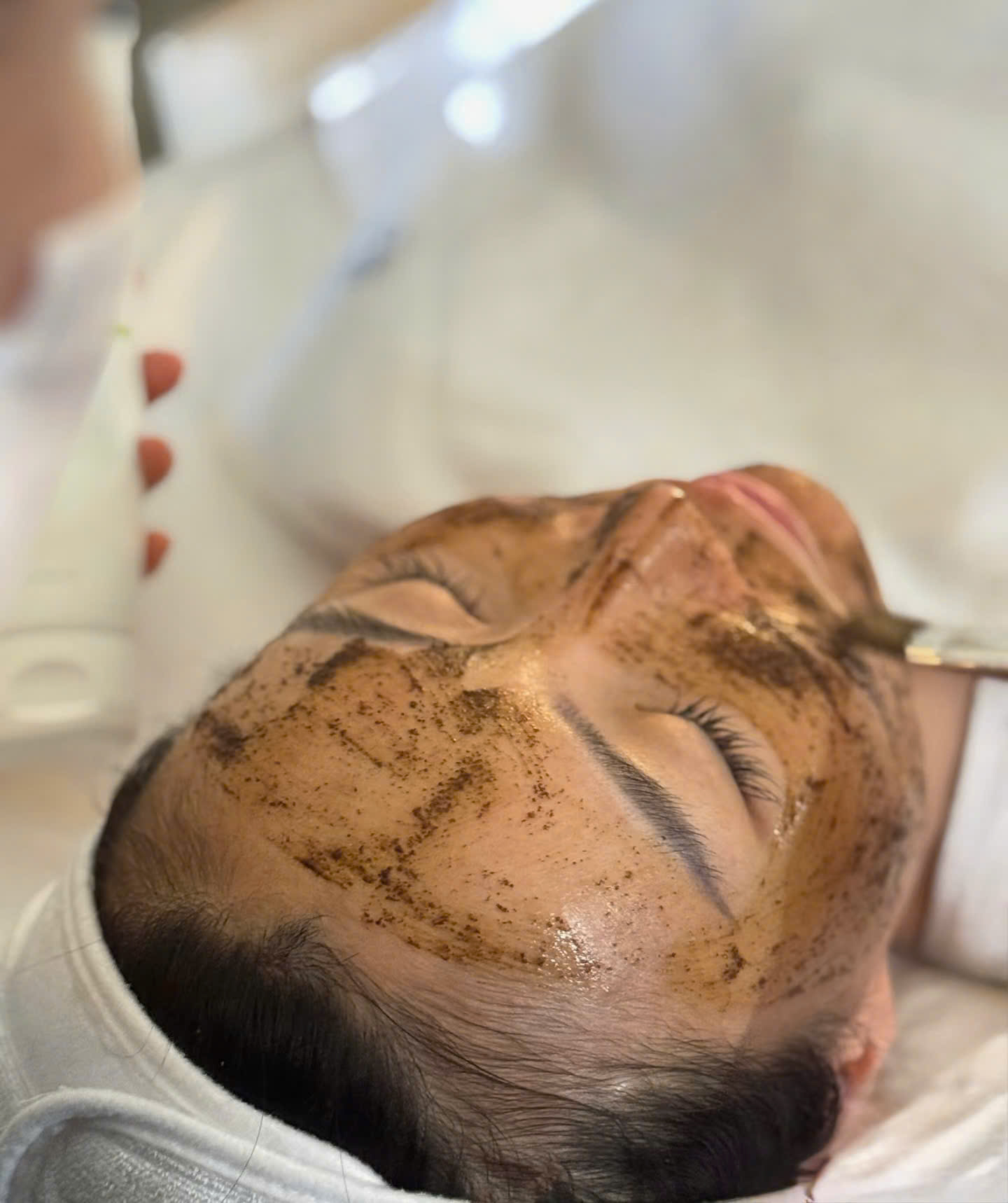 Liệu trình Comodex Acne By Christina
